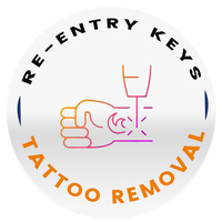 Member SEA's Tattoo Removal Program in Los Angeles CA